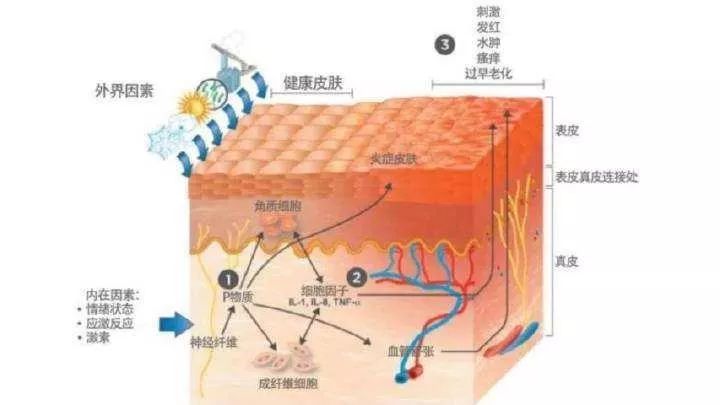 豐臺(tái)區(qū)“屏障修復(fù)”修復(fù)的是什么？不同膚質(zhì)該如何搭配？